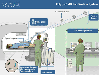 Imagen: Un diagrama del sistema de localización Calypso 4-D, mostrando los transpondedores electromagnéticos (Fotografía cortesía de Varian Medical Systems).